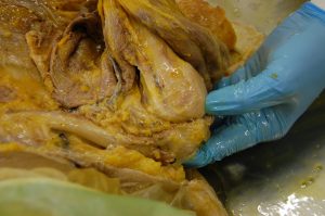 Shoulder dissection dynamecho